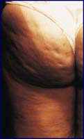Read a diet and weight loss article to improve men and women's health.